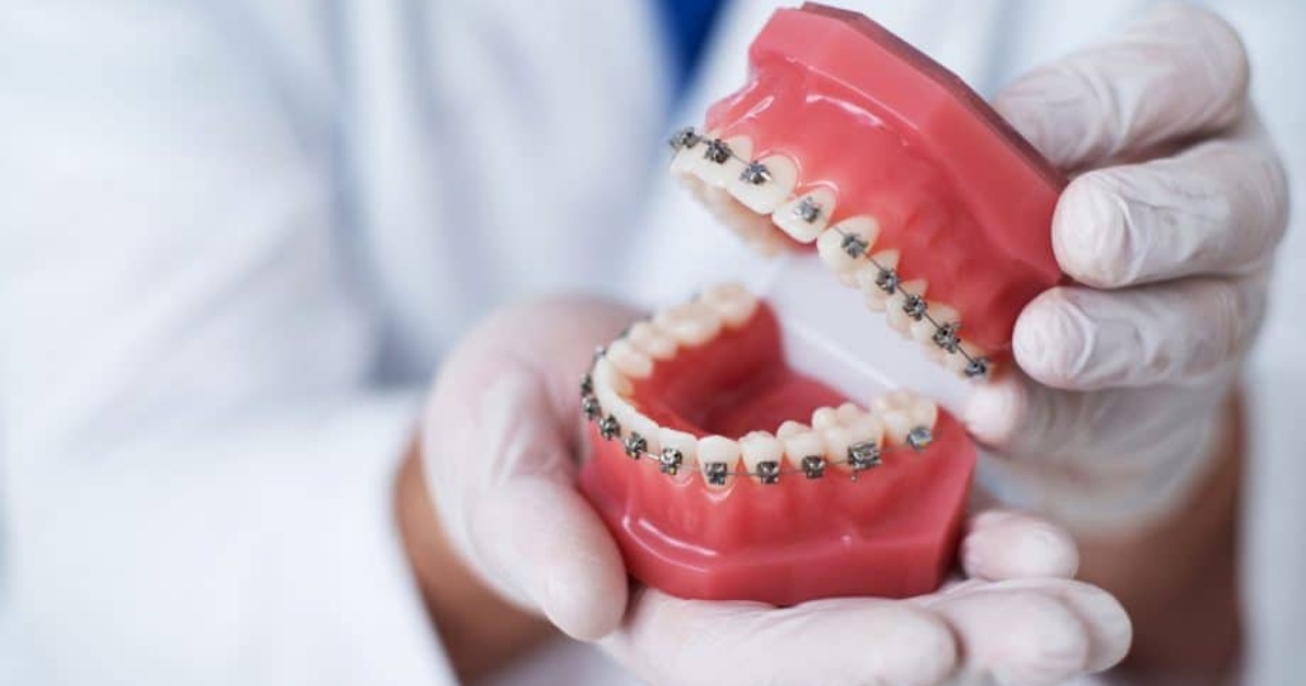 Checklist Before Getting Braces From A General Dentist