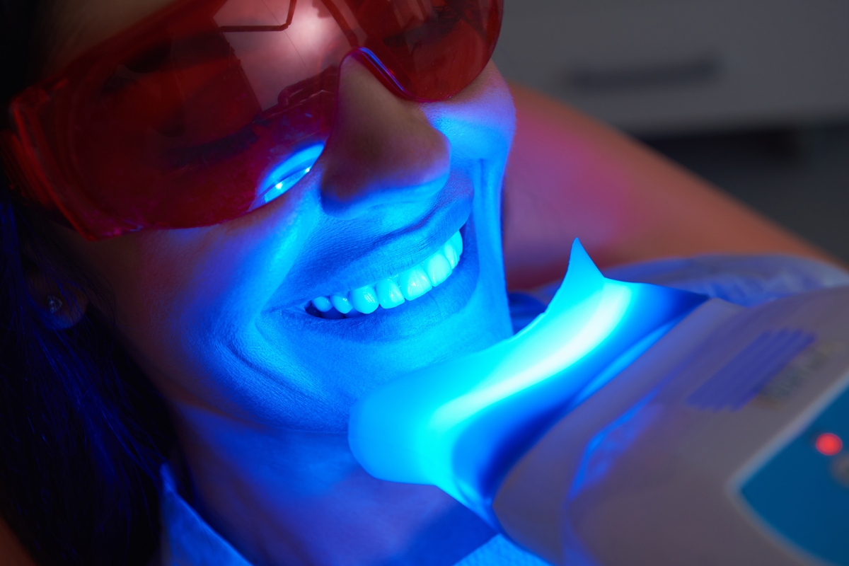 teeth-whitening-in-Canton-Township