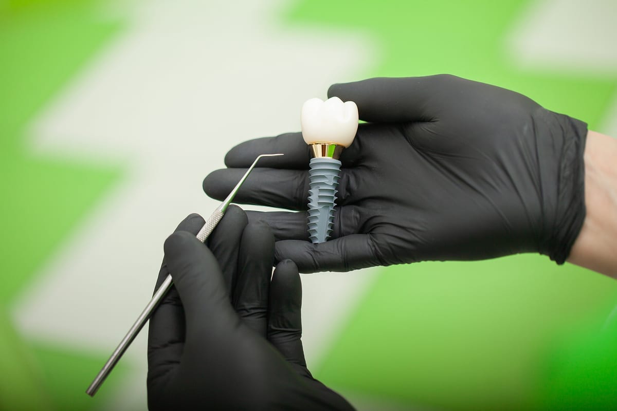 Dental Implants in Canton Township