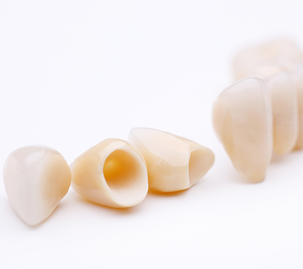 Canton Dental Crowns and Dental Bridges