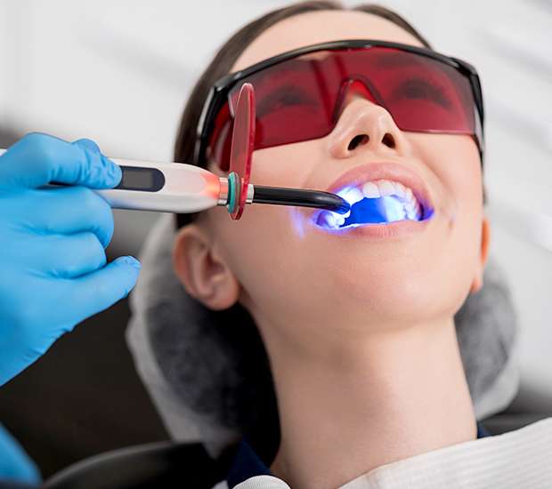 Canton Professional Teeth Whitening